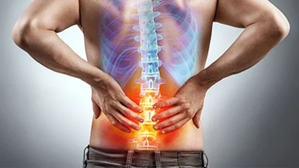 Back Pain